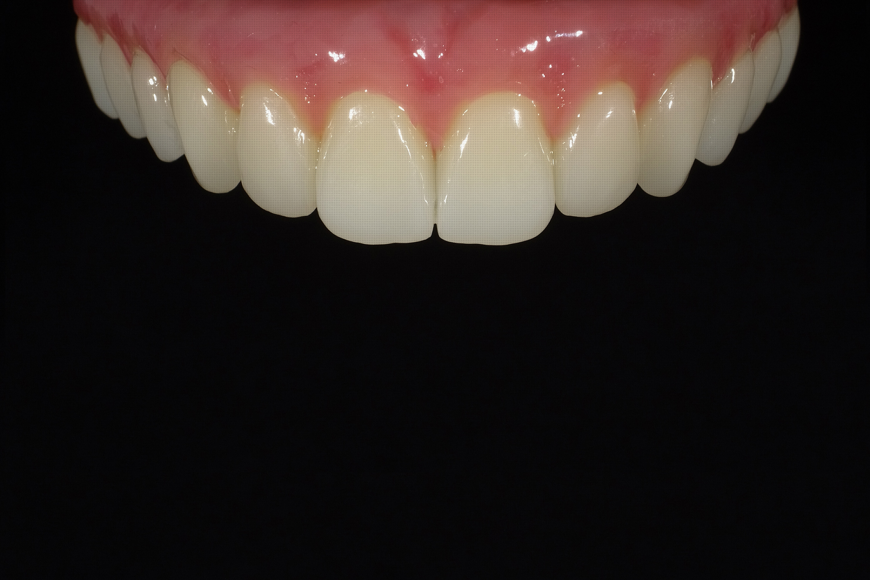 dita dental